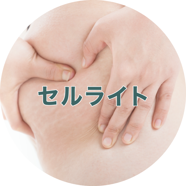 セルライト